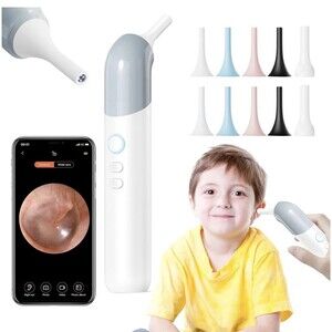 Qimic Otoscope Ear Camera: 1080P HD Display with LED Lights for Clear Ear scope